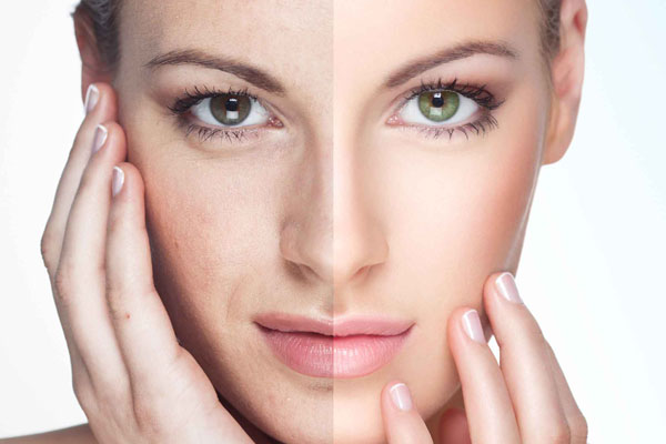 ANTES Y DESPUÉS CON PRP DERMAPEN