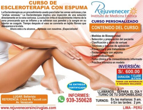 ESCLEROTERAPIA